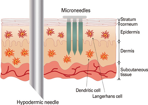 DNA Vaccines and Intradermal Vaccination by DNA Tattooing