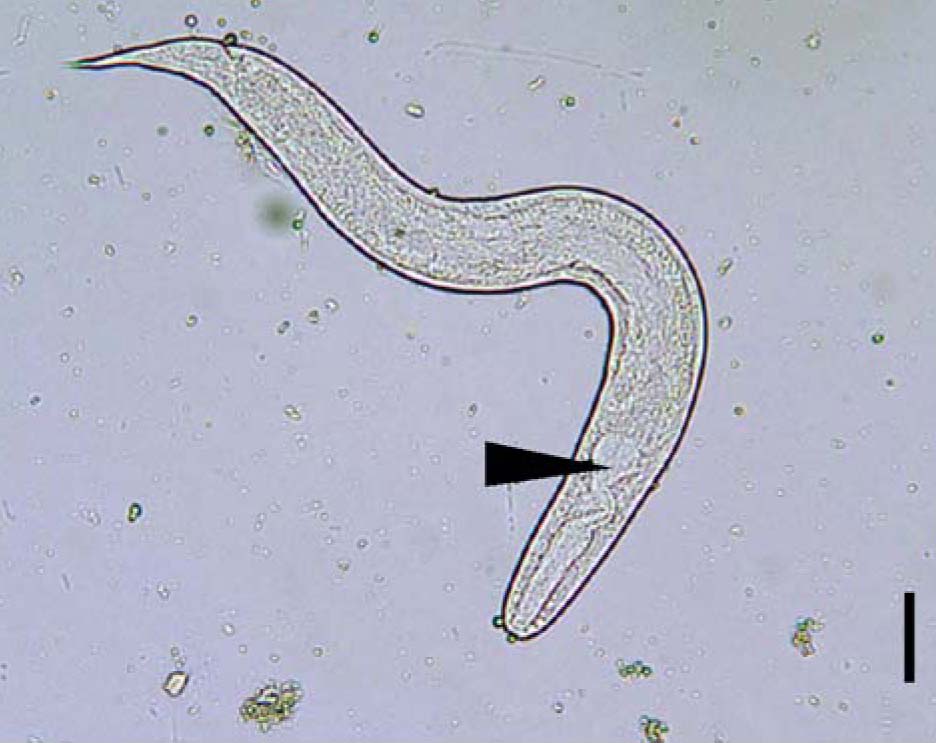 strongyloides larvae