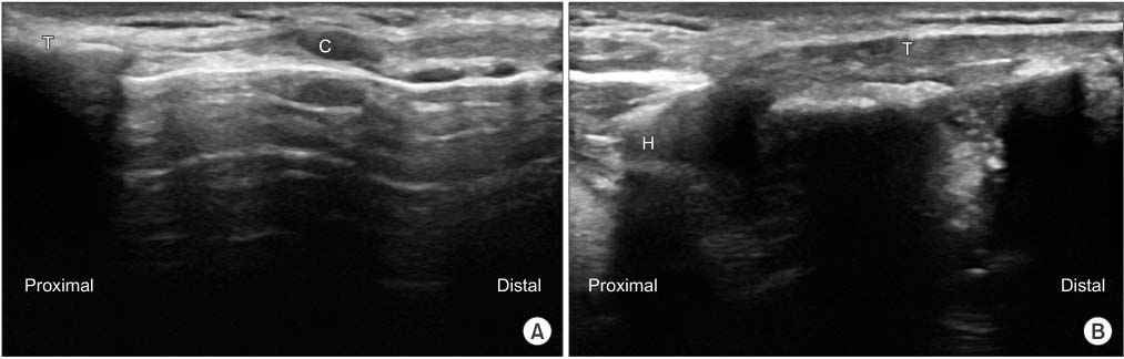 Real-World Retrospective Review of Axial Neck Pain Relief Following  Peripheral Nerve Stimulation of Cervical Medial Branch Nerves – SPR  Therapeutics