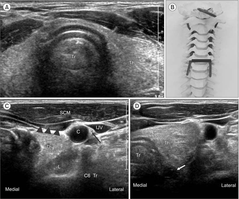 Real-World Retrospective Review of Axial Neck Pain Relief Following  Peripheral Nerve Stimulation of Cervical Medial Branch Nerves – SPR  Therapeutics