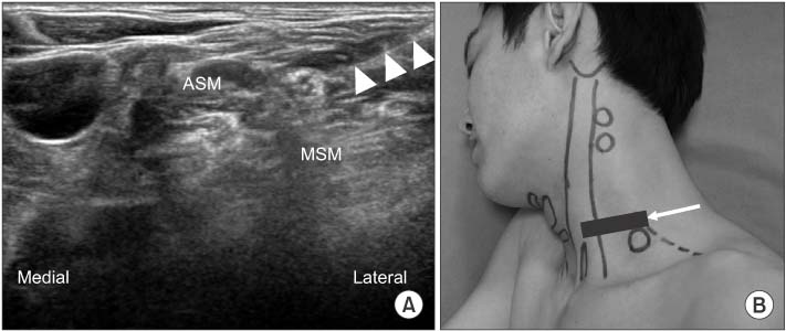 Real-World Retrospective Review of Axial Neck Pain Relief Following  Peripheral Nerve Stimulation of Cervical Medial Branch Nerves – SPR  Therapeutics