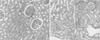 jkms-20-612-g003