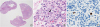 jkms-33-e82-g002