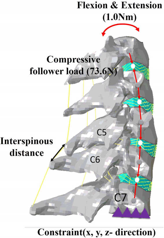 jkns-60-6-611f3.gif