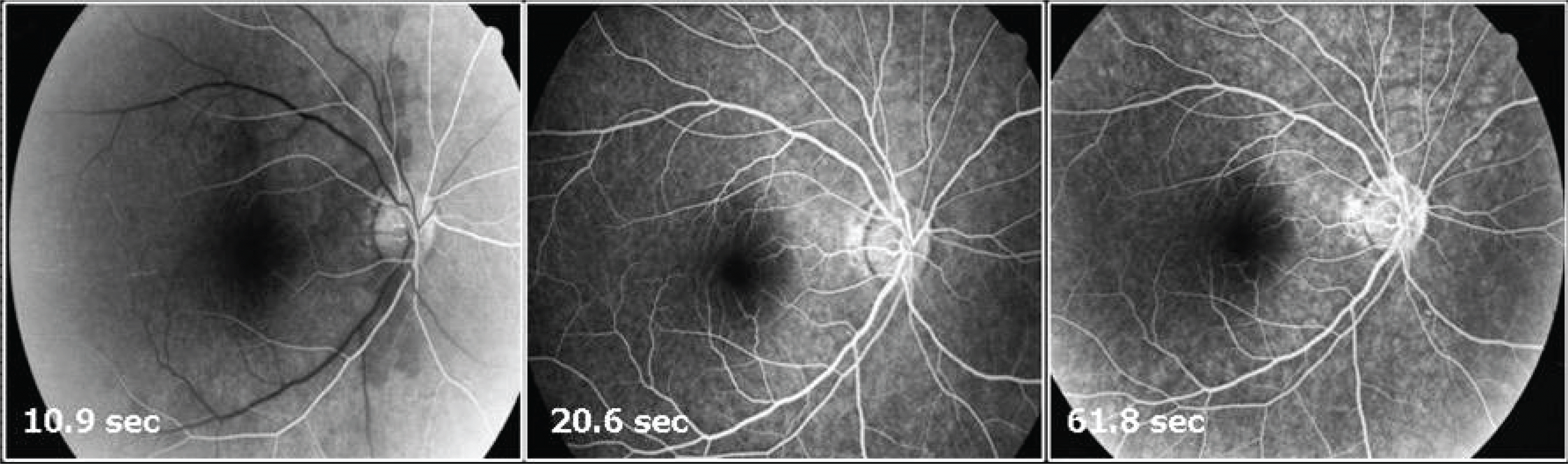 jkos-50-324f3.tif