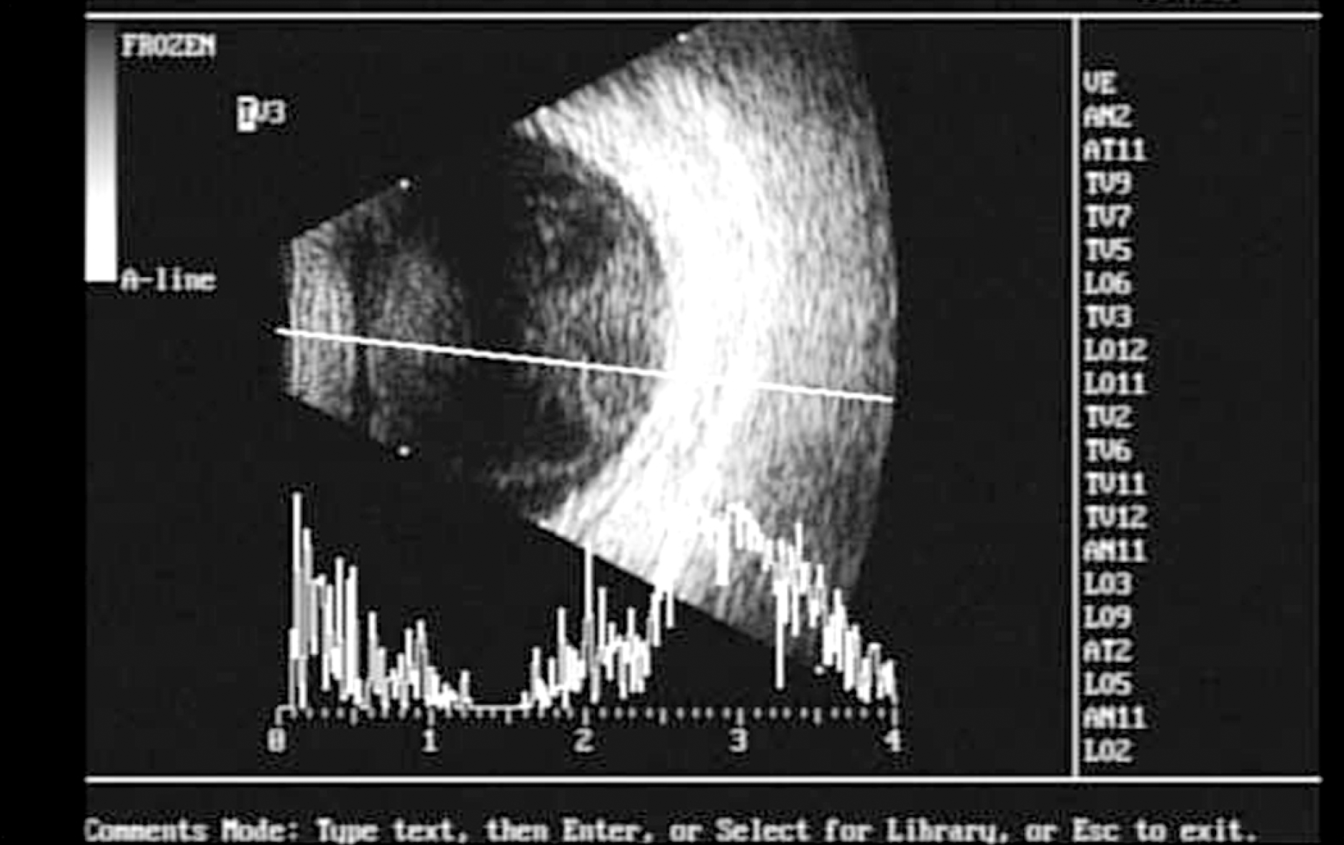 jkos-52-1249f2.tif