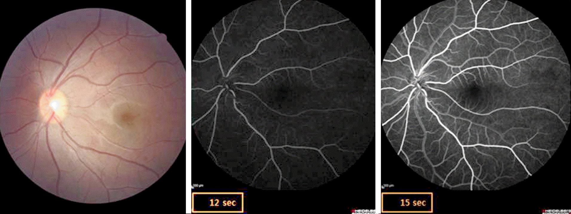 jkos-55-304f3.tif