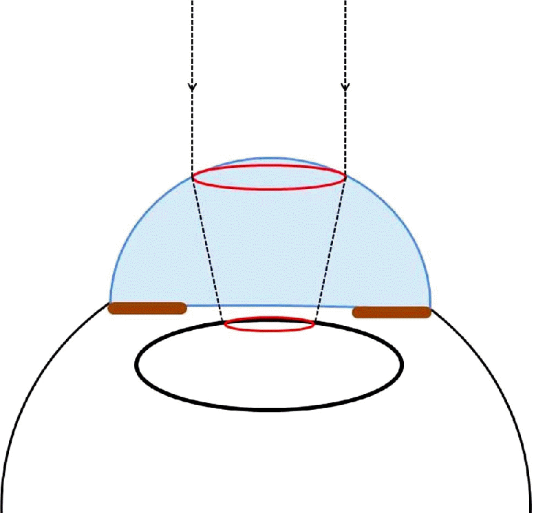 jkos-55-374f1.tif