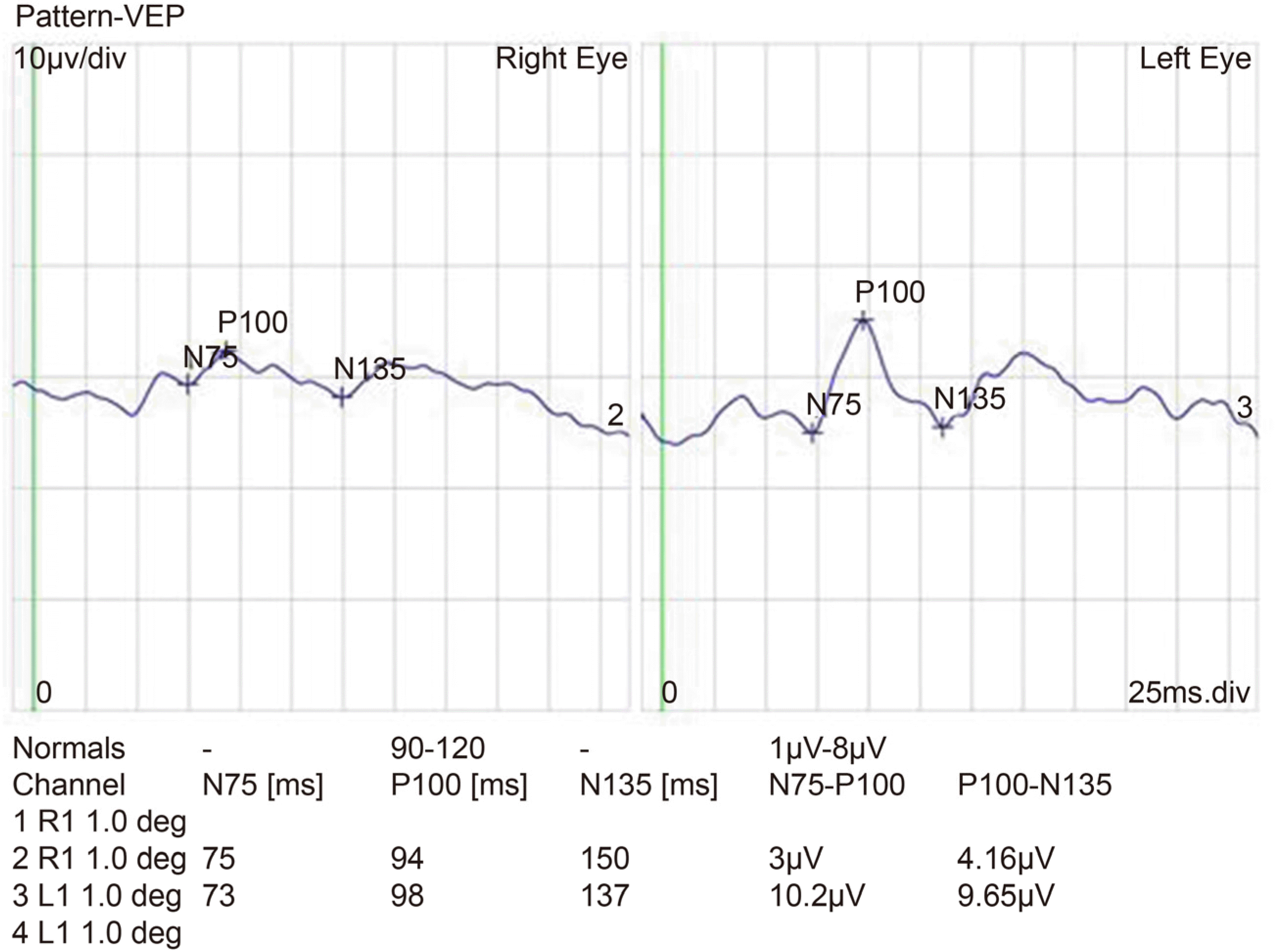 jkos-59-893f5.tif