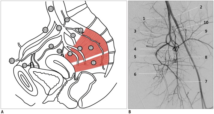 obturator artery angiogram