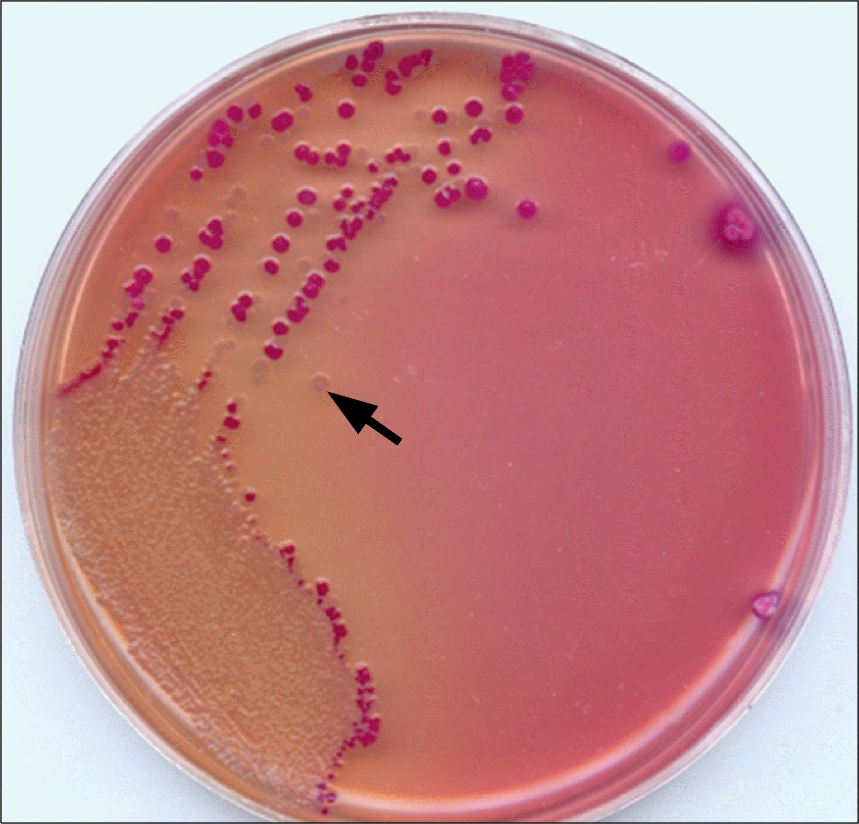 Escherichia coli в сперме у мужчин фото 85