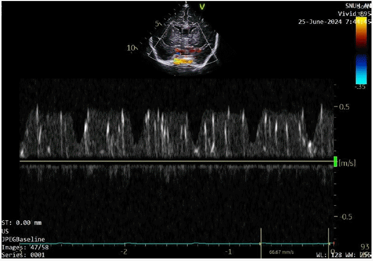 apm-24106f6.tif