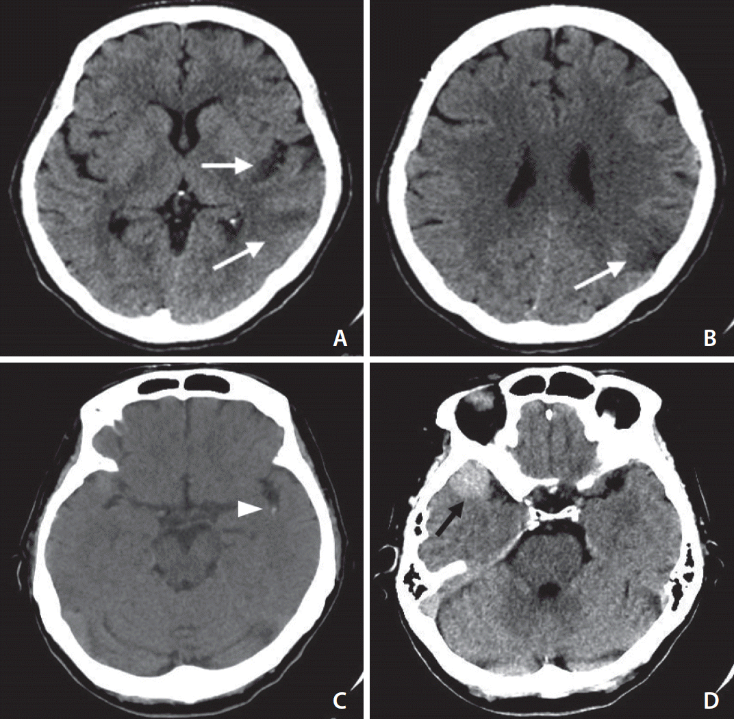 neuroint-2020-00290f2.tif