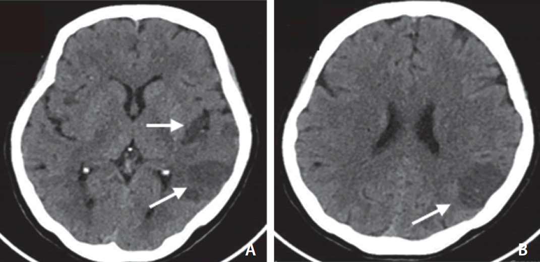 neuroint-2020-00290f3.tif