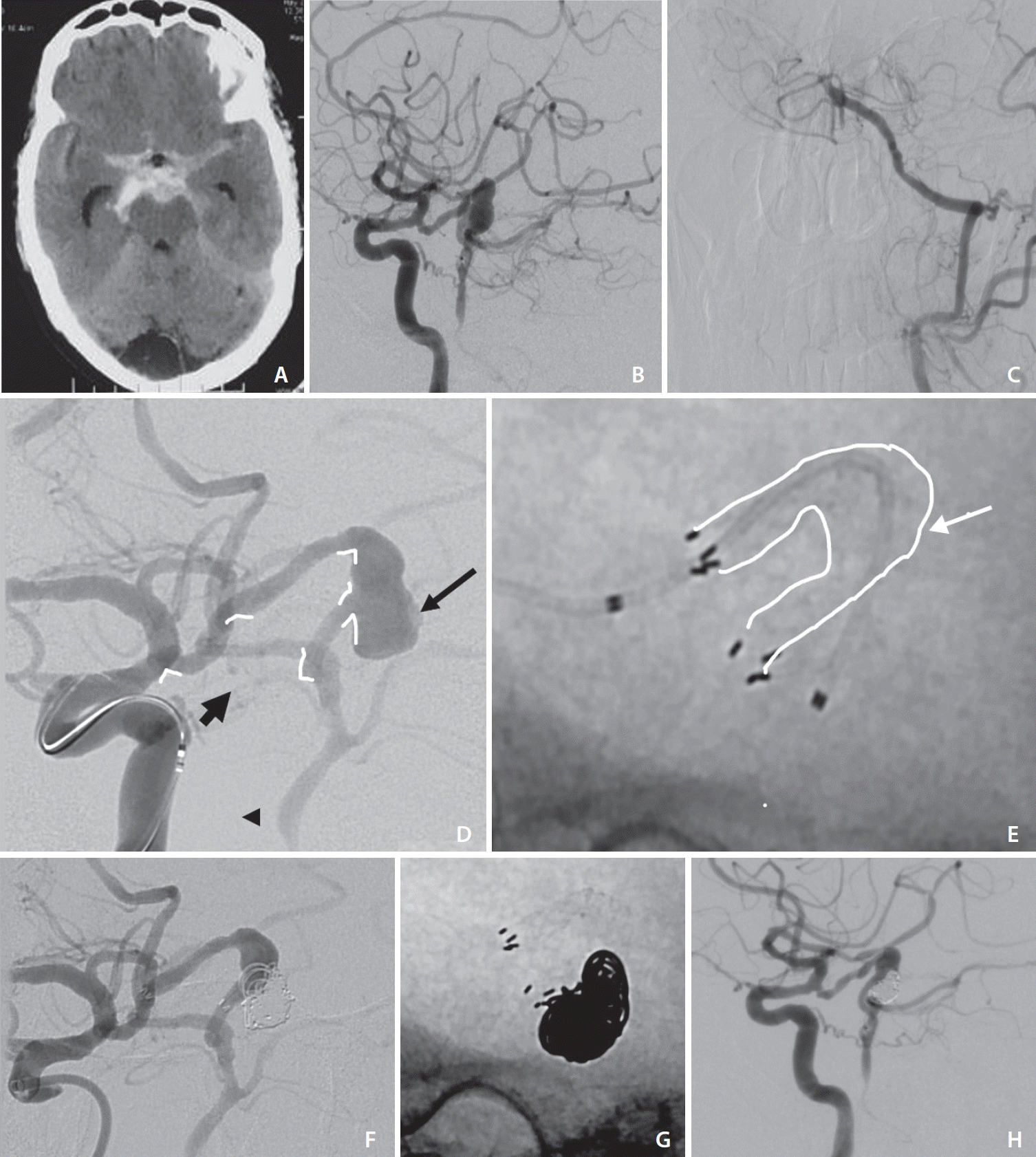 neuroint-2023-00472f1.tif