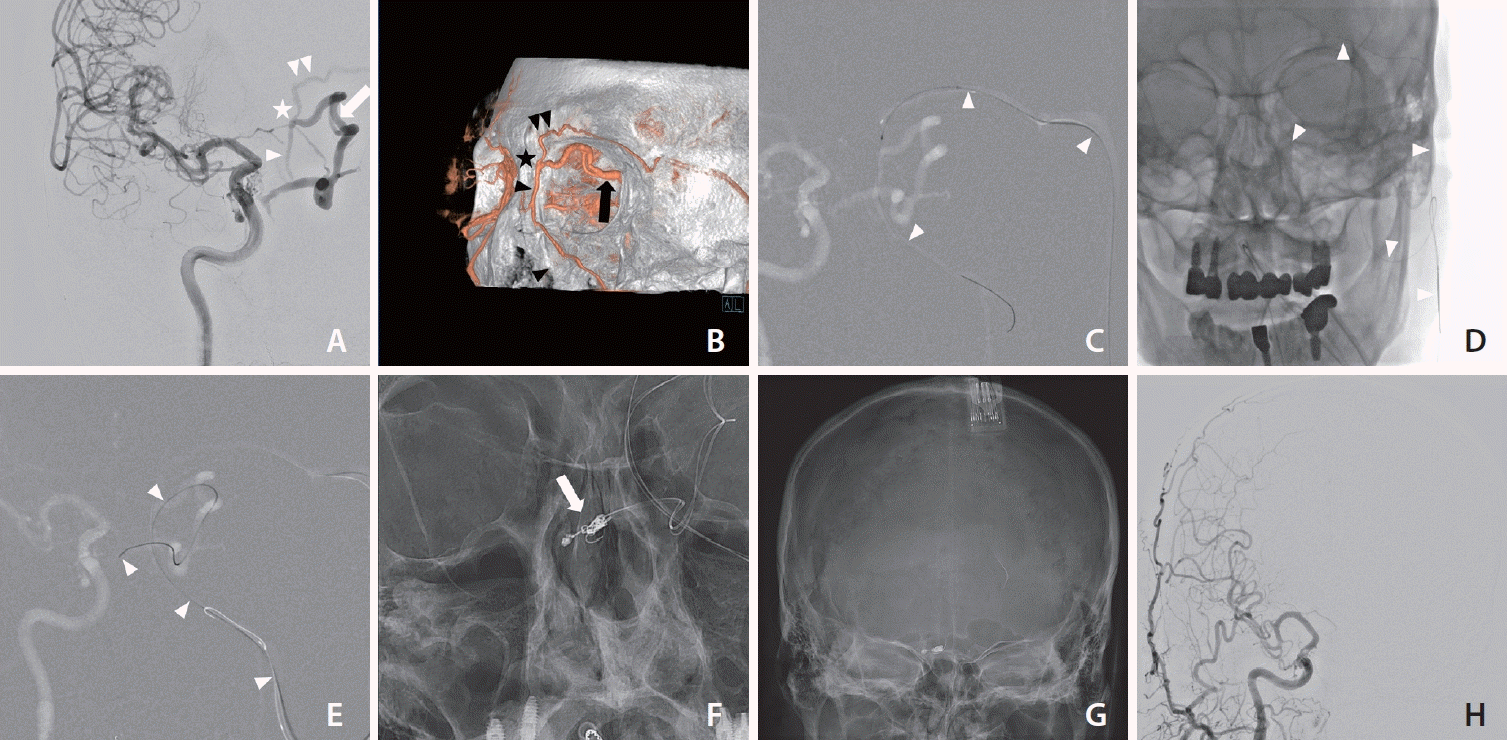 neuroint-2023-00493f1.tif