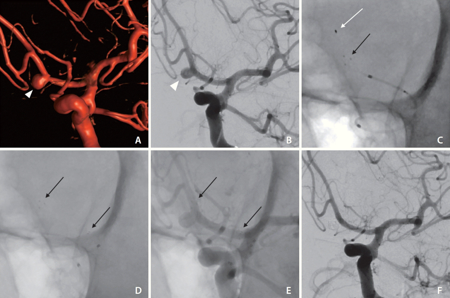 neuroint-2024-00066f1.tif