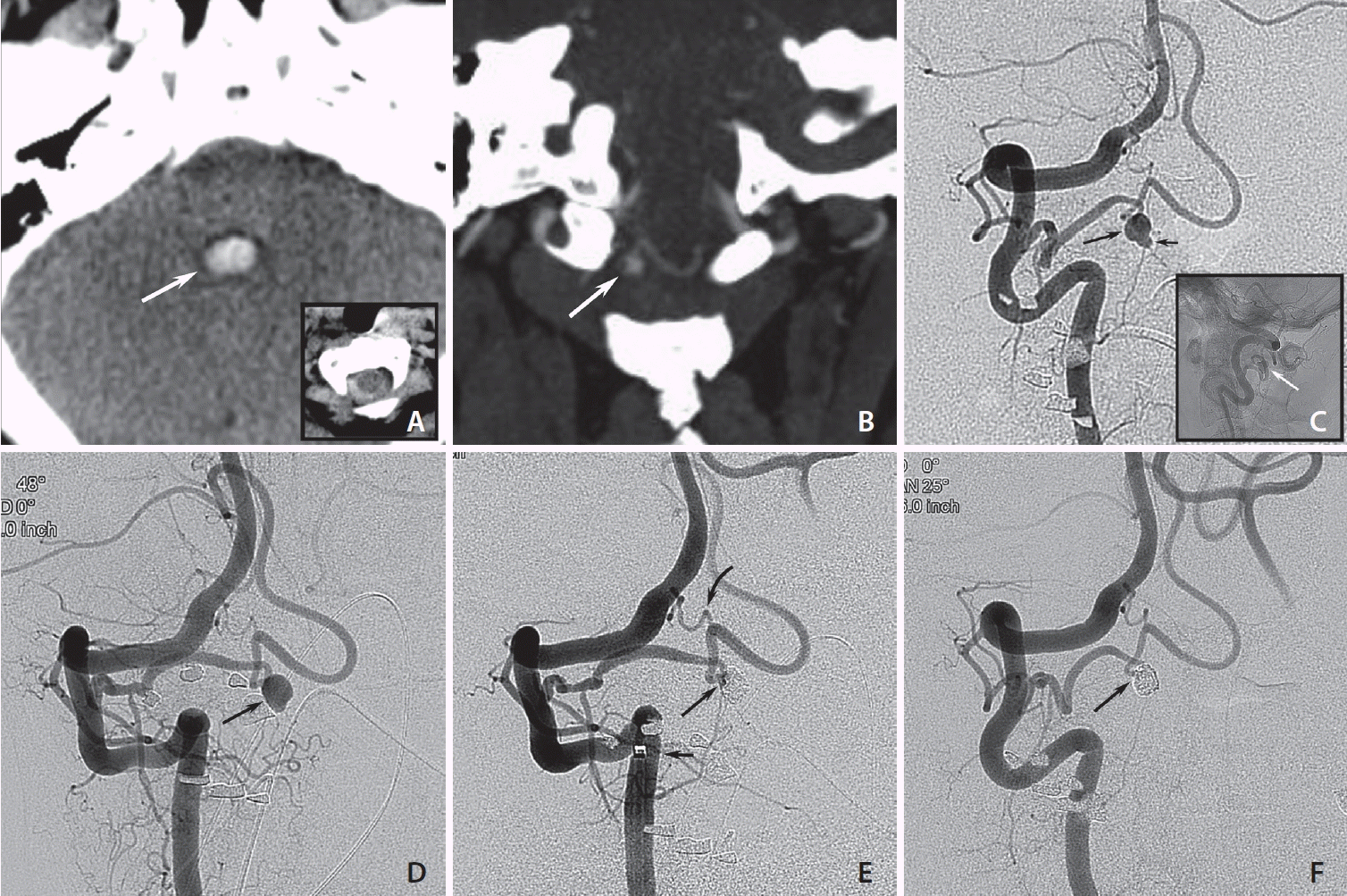 neuroint-2024-00136f1.tif