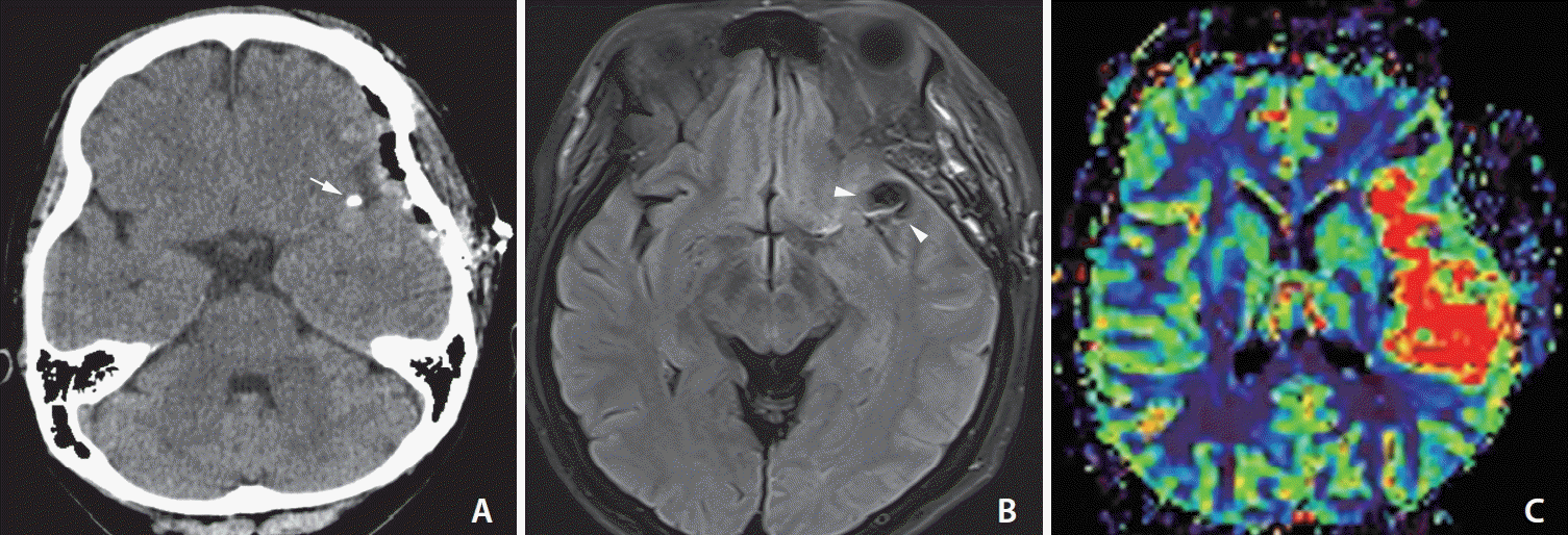 neuroint-2024-00150f2.tif