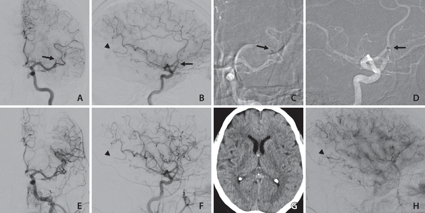 neuroint-2024-00171f1.tif