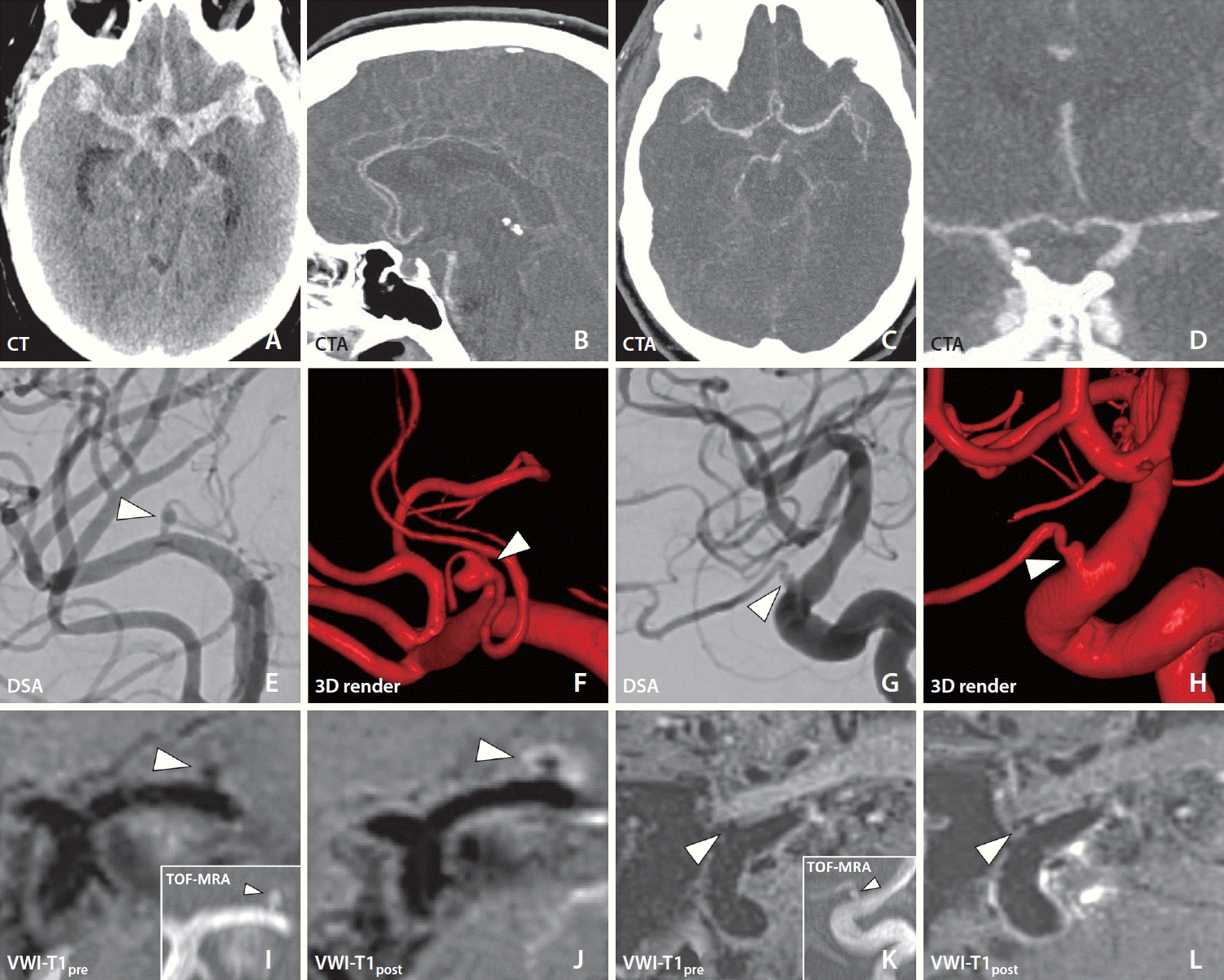 neuroint-2024-00185f1.tif