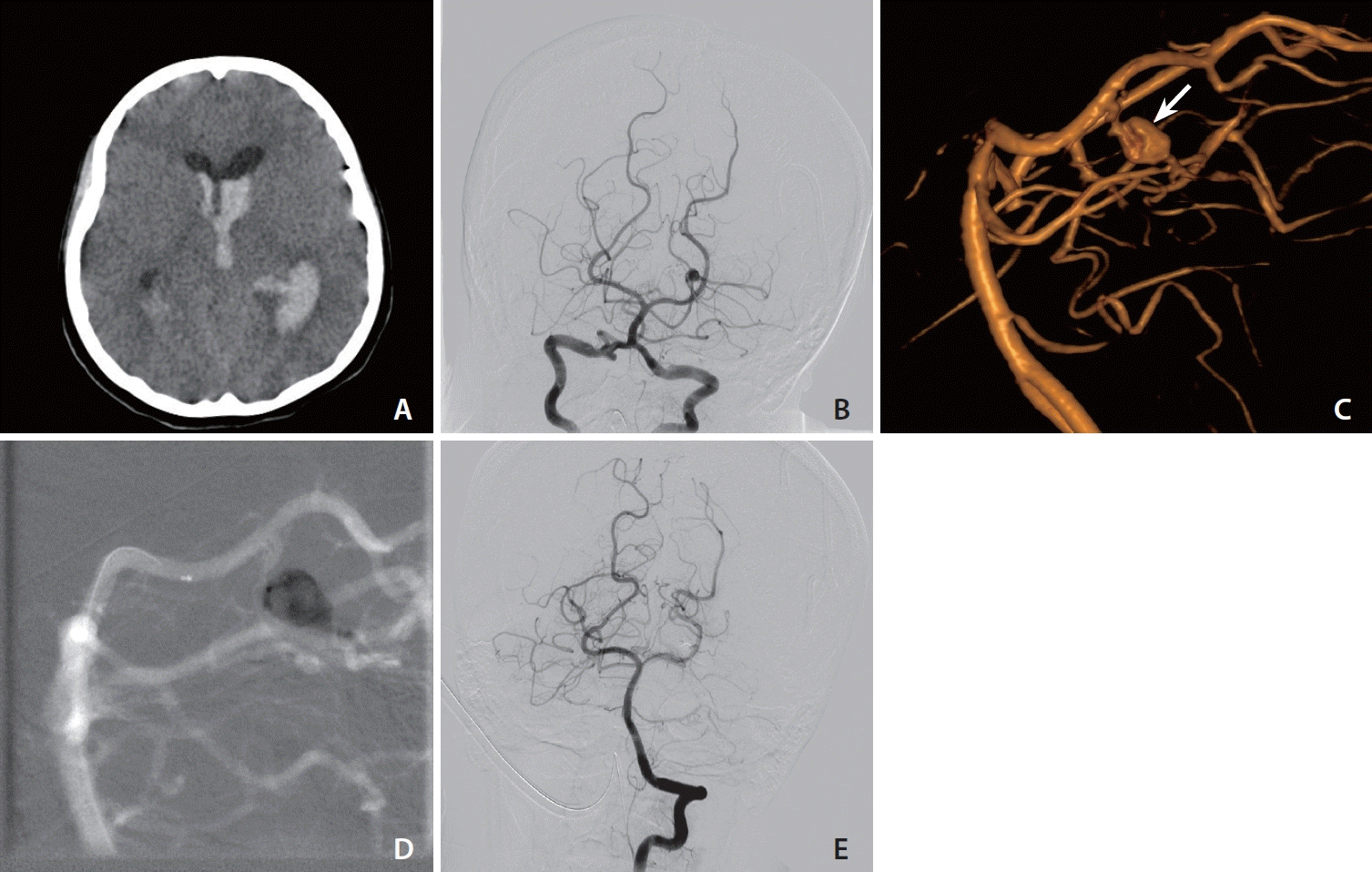 neuroint-2024-00290f1.tif