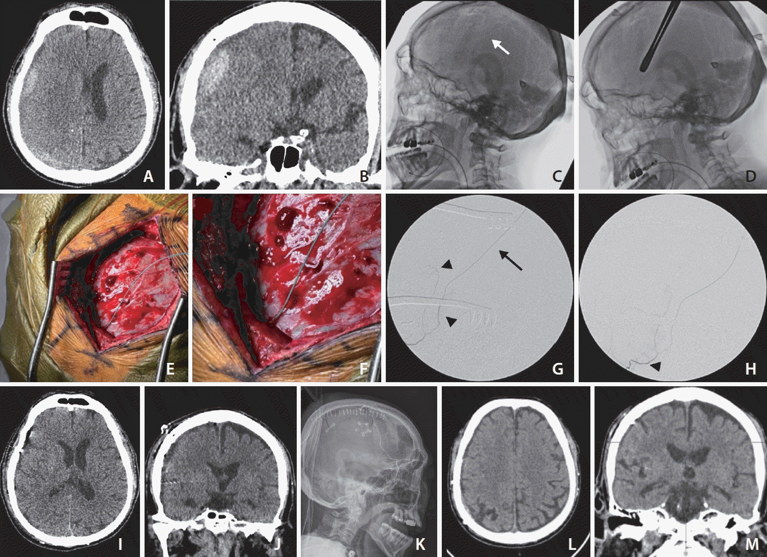 neuroint-2024-00297f1.tif