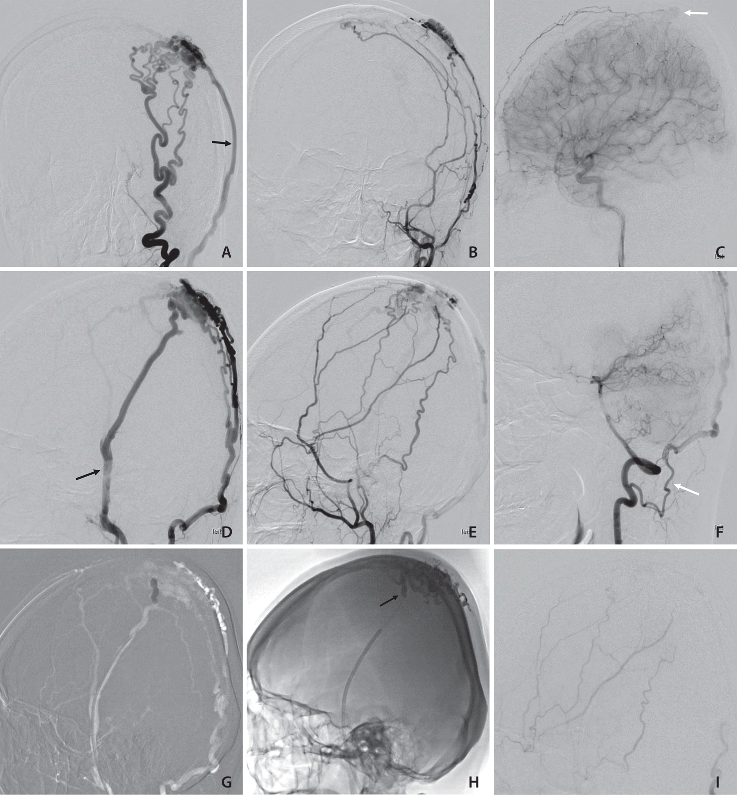 neuroint-2024-00374f1.tif