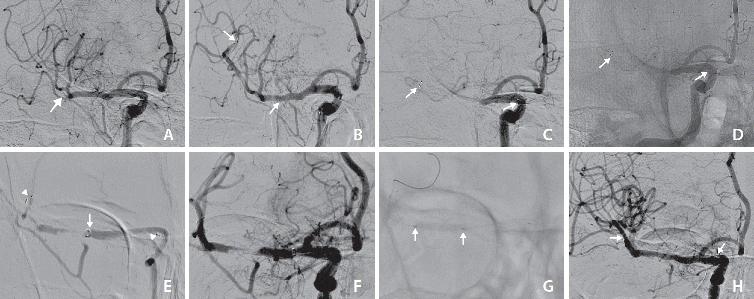 neuroint-2024-00409f1.tif