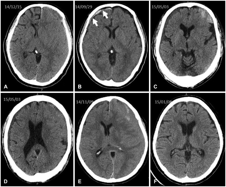 kjn-14-61-g003