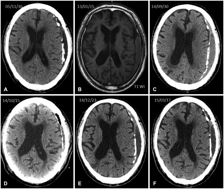 kjn-14-61-g004