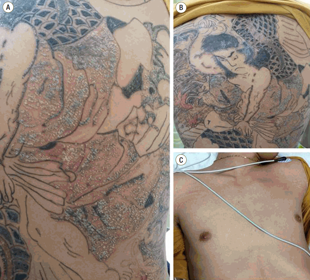 What You Should and Shouldnt Do When Getting a Tattoo  Certified Tattoo  Studios