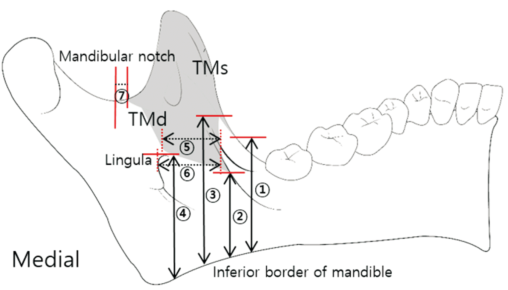 Muscle temporal (crotaphyte) : définition, rôle, schéma