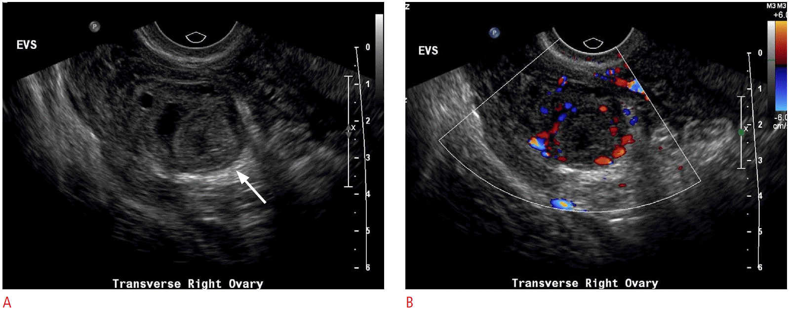 usg-15013-f3.tif