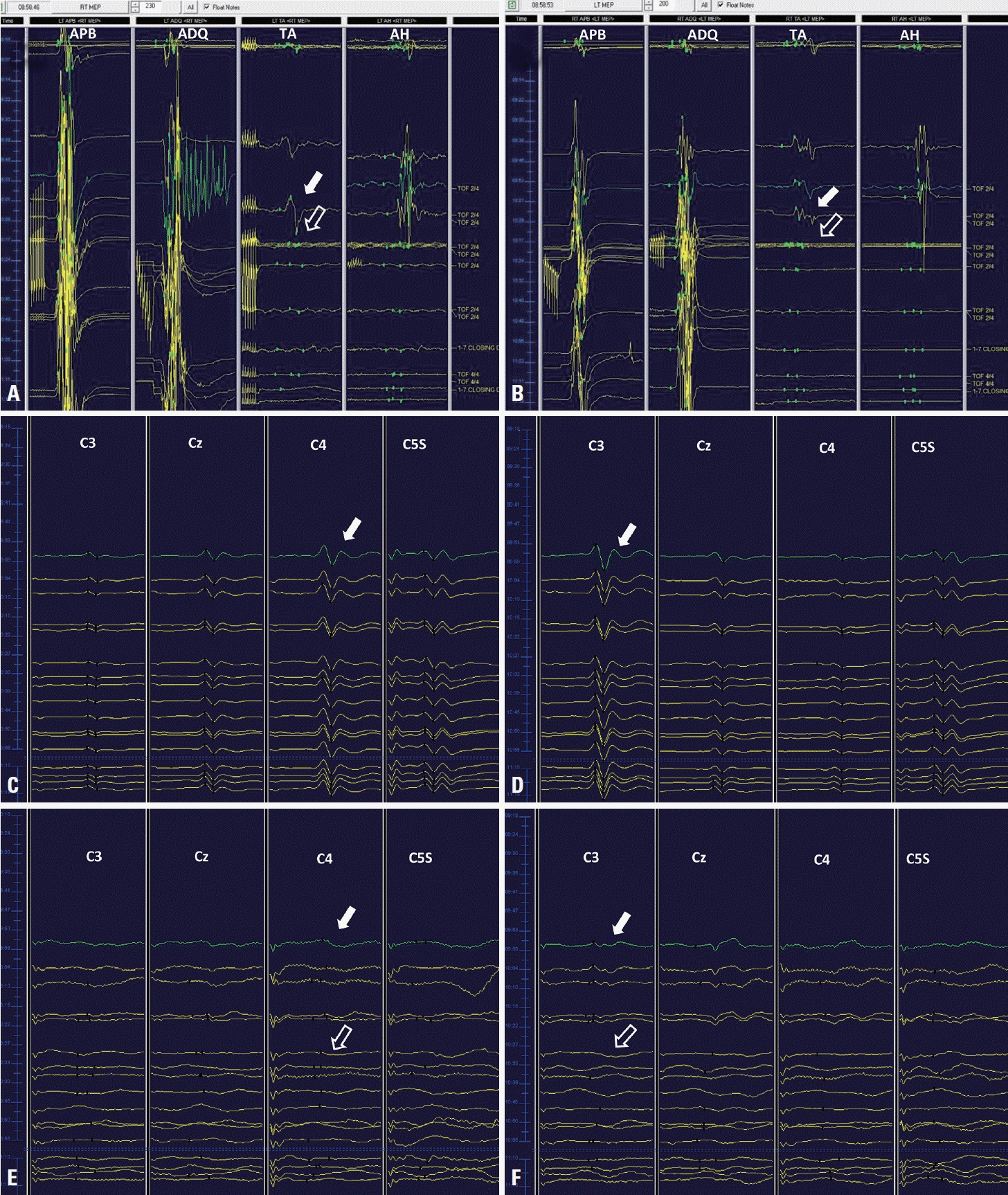 acn-24003f3.tif