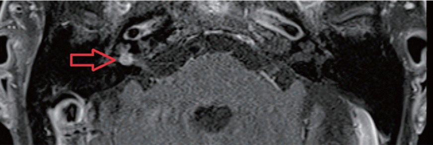acn-24006f9.tif