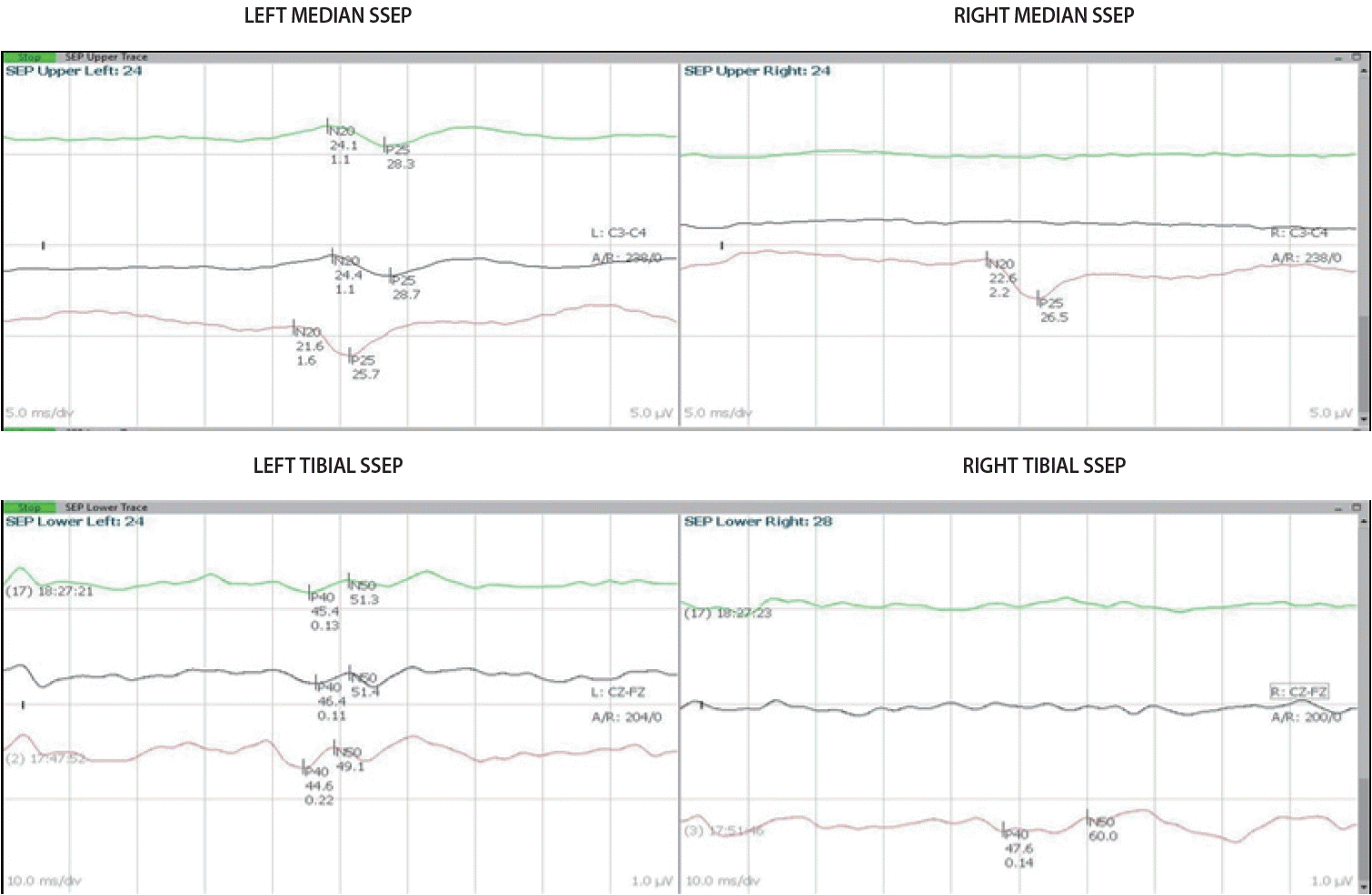 acn-25002f1.tif