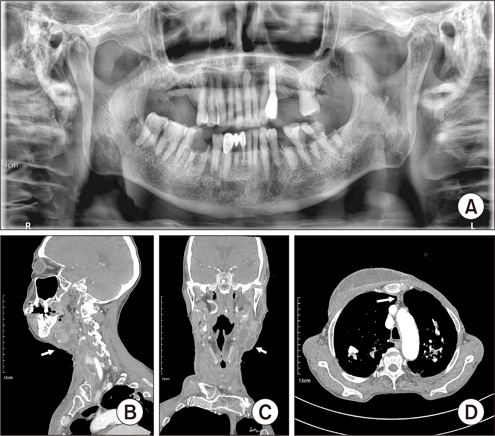 jkaoms-52-1-34-f1.tif